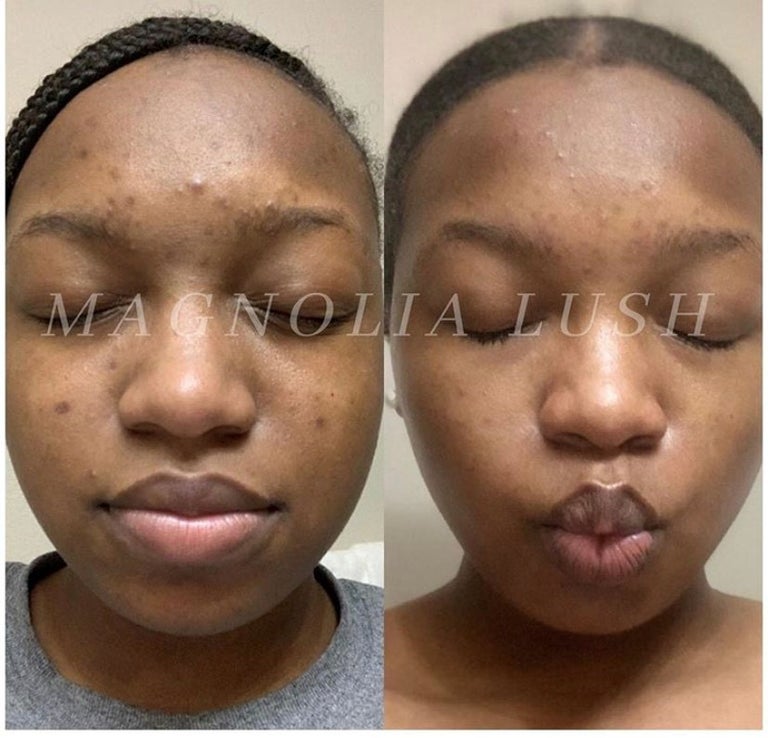 BB Créme Daily Moisturizer